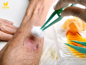 vết thương hở ăn trứng gà được không