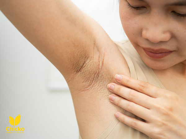 cách trị thâm nách bằng trứng gà